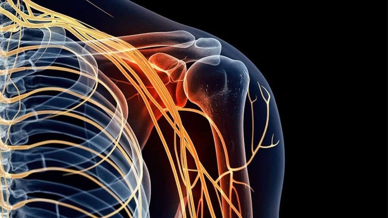 Tìm hiểu về đau dây thần kinh ngoại biên 1