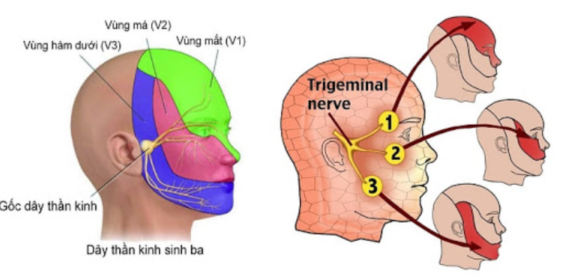 Tìm hiểu về đau dây thần kinh số 5-1