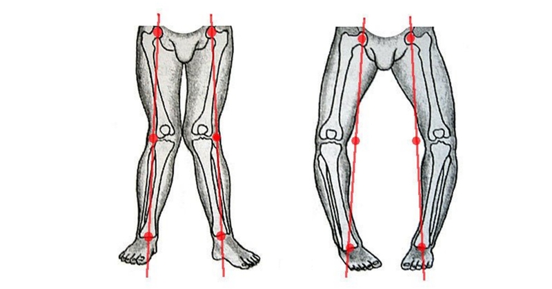 Tìm hiểu về dấu hiệu trẻ còi xương 2