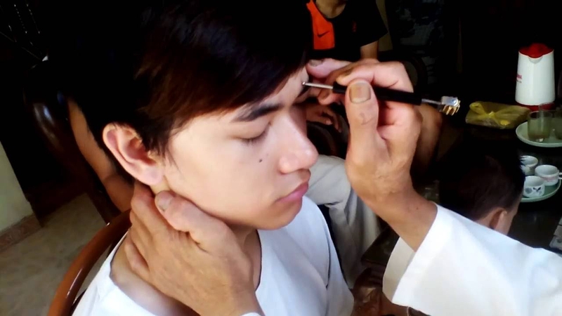 Tìm hiểu về diện chẩn chữa gai cột sống 1