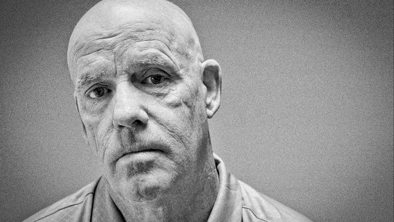 Tìm hiểu về hội chứng người hóa đá1