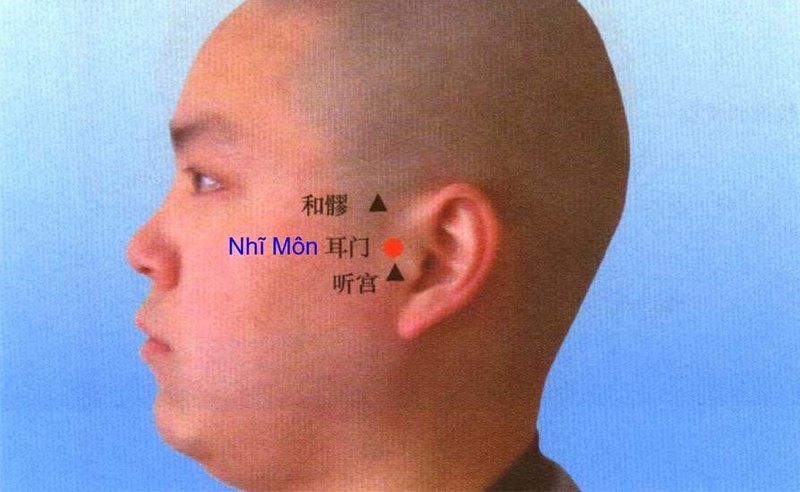 Huyệt nhĩ môn là huyệt đạo thứ 21 của Kinh Tam Tiêu