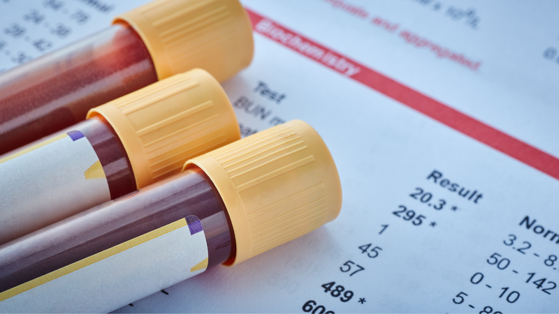 Tìm hiểu về kháng thể: Hiệu giá kháng thể là gì? 4