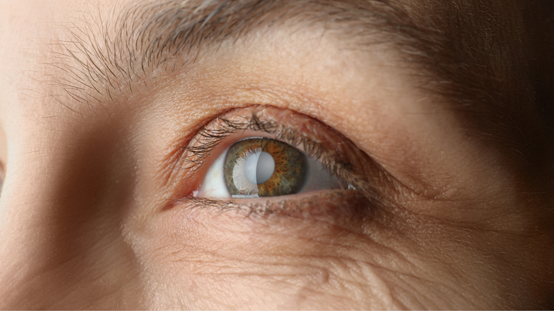 Đồng tử là gì? Kích thước, chức năng và những rối loạn ảnh hưởng đến đồng tử 3