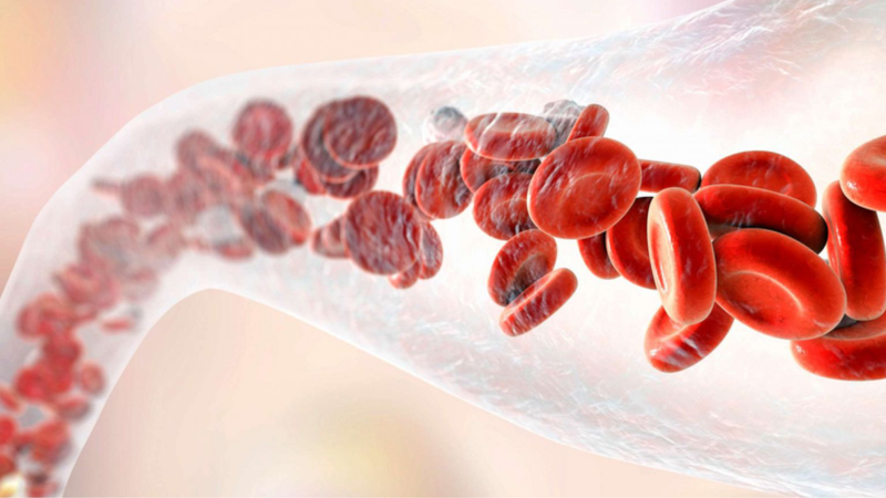 Tìm hiểu về kỹ thuật chụp mạch máu số hóa xóa nền (DSA) 2