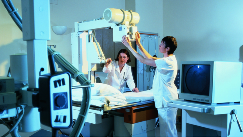 Tìm hiểu về kỹ thuật chụp mạch máu số hóa xóa nền (DSA) 3