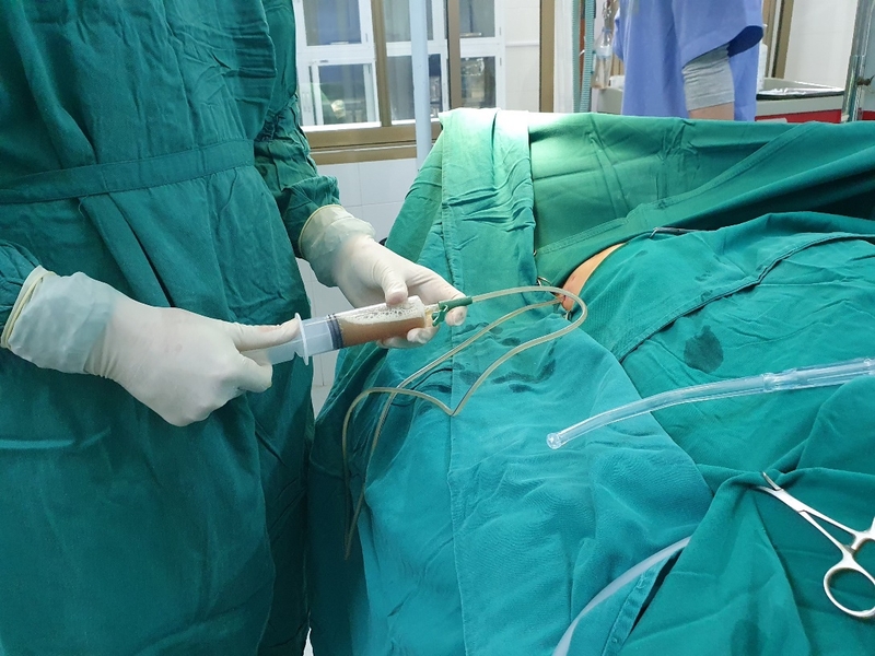 Tìm hiểu về kỹ thuật mở màng phổi tối thiểu hiện nay 1