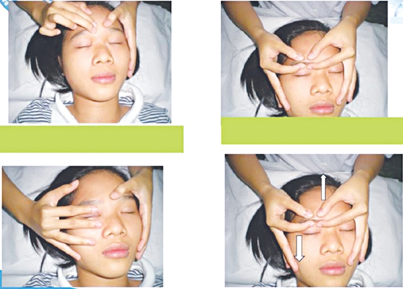 Tìm hiểu về phương pháp bấm huyệt chữa méo miệng, liệt mặt3