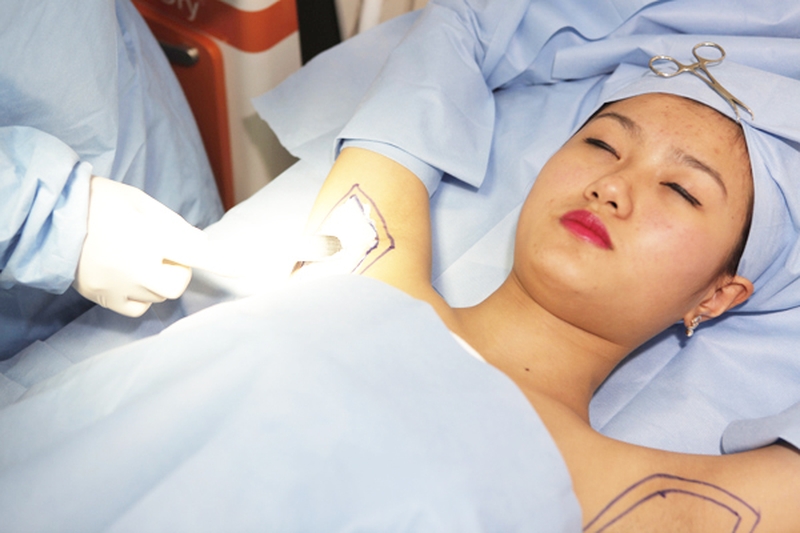 Chữa hôi nách phẫu thuật có đau không?-3