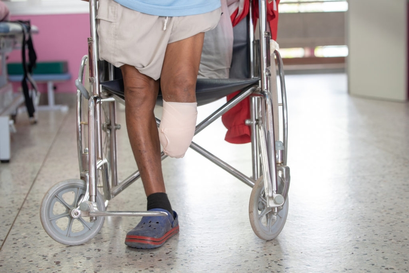 Tìm hiểu về rủi ro sau khi cắt cụt chi 2