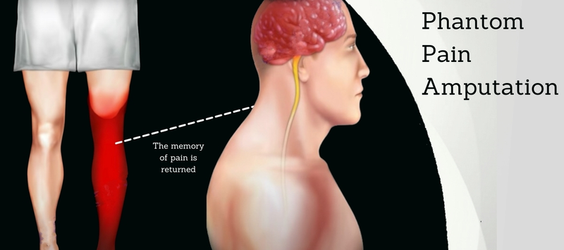 Tìm hiểu về rủi ro sau khi cắt cụt chi 4