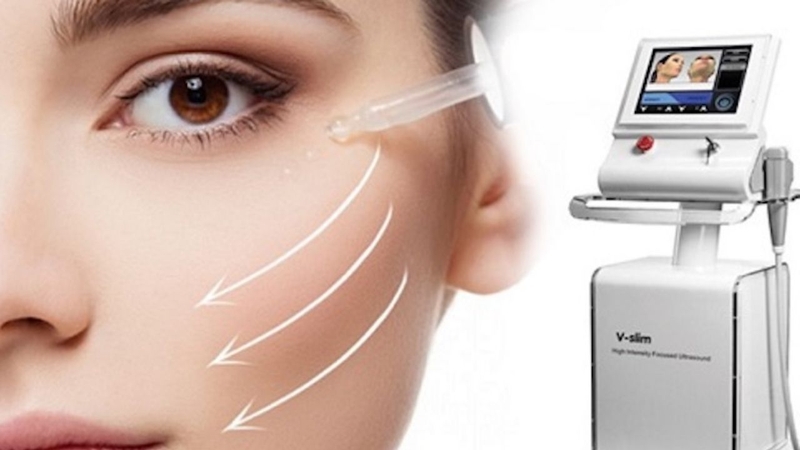 Tìm hiểu về tác hại của nâng cơ hifu trong thẩm mỹ da 2