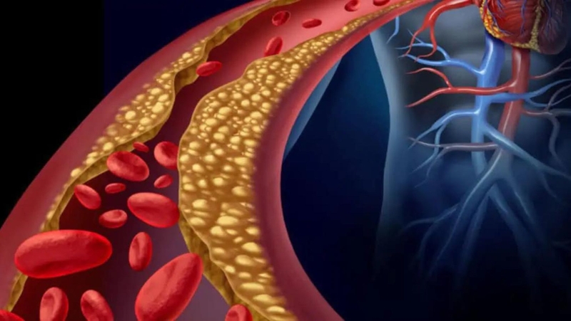 tìm hiểu về thuốc làm tan mảng xơ vữa động mạch2