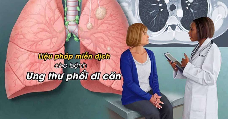 Tìm hiểu về thuốc miễn dịch điều trị ung thư phổi 1