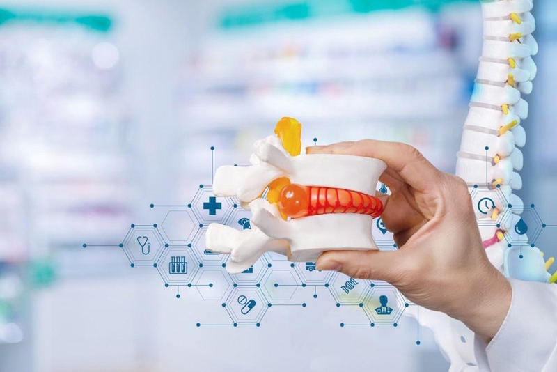 Tìm hiểu về tình trạng thoát vị đĩa đệm chèn dây thần kinh