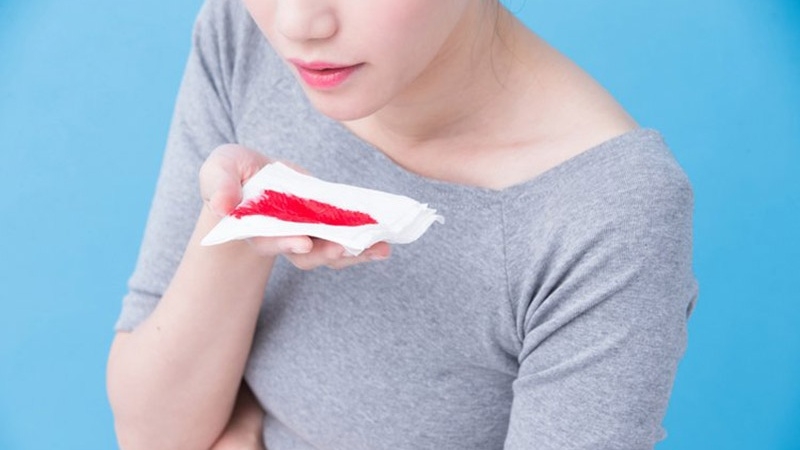 viêm xoang khạc ra máu 1