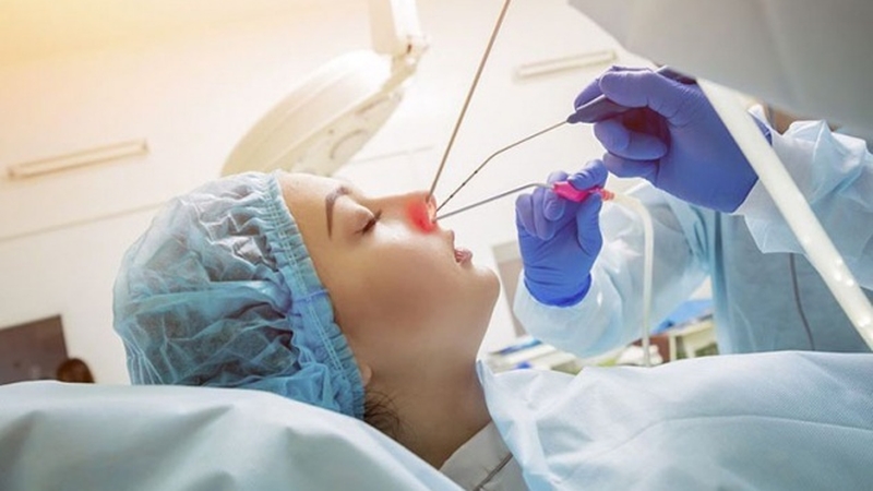 điều trị viêm xoang khạc ra máu 3