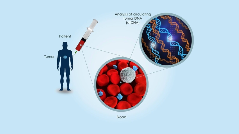 Tìm hiểu về xét nghiệm DNA khối u tuần hoàn 2