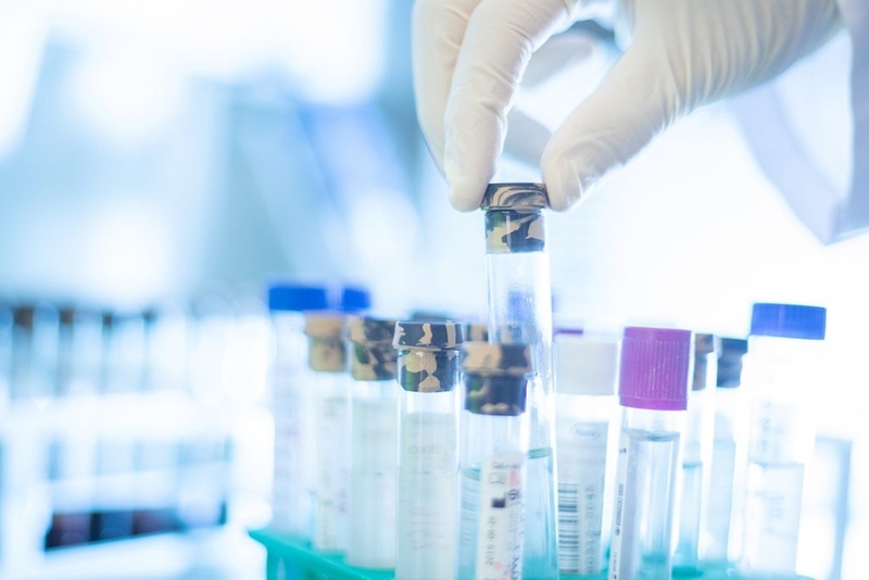 Tìm hiểu về xét nghiệm DNA khối u tuần hoàn 3