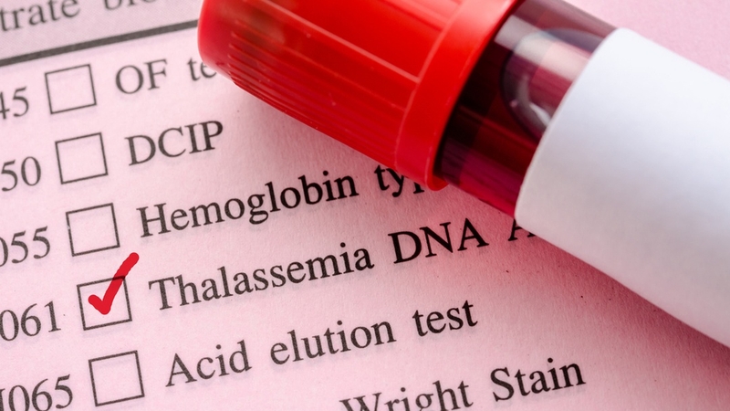 Tìm hiểu xét nghiệm gen Thalassemia để phát hiện bệnh tan máu bẩm sinh 3