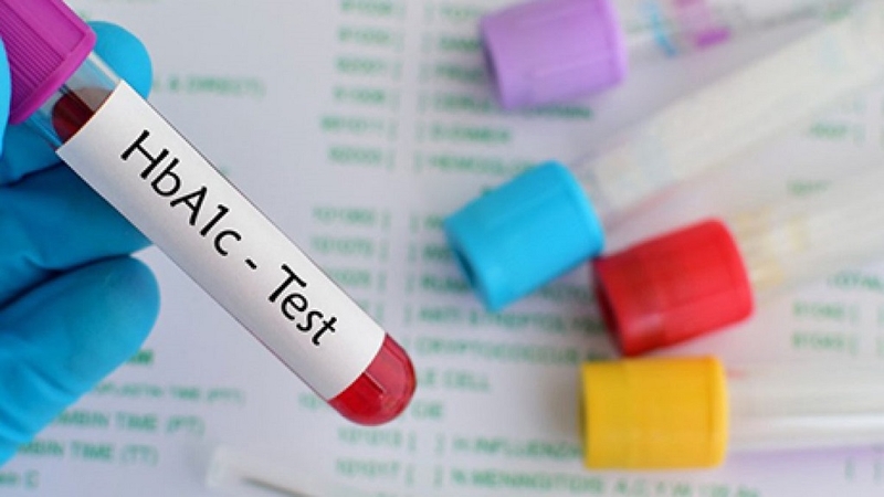Tìm hiểu xét nghiệm HbA1c IFCC là gì? Những trường hợp cần xét nghiệm HbA1c IFCC 3