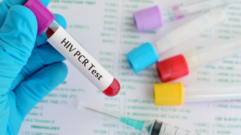 Tìm hiểu xét nghiệm HIV ở trẻ sơ sinh 2