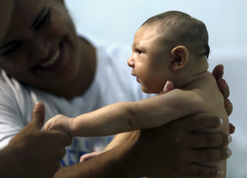 Virus Zika là tác nhân gây ra dị tật hội chứng đầu nhỏ cho trẻ em