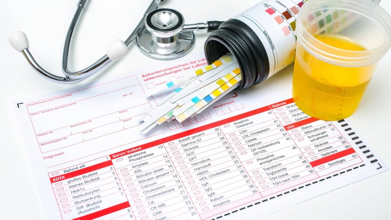 Tìm hiểu ý nghĩa của chỉ số SG trong nước tiểu 2