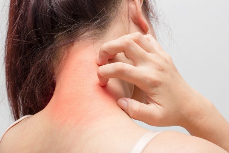 Tinh dầu bơ có tác dụng gì? Những lưu ý khi sử dụng tinh dầu bơ 3