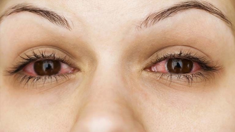 Tinh dầu có thể làm giảm viêm: Những loại tinh dầu tốt nhất và cách dùng hiệu quả 4