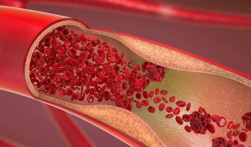 Tĩnh mạch dưới lưỡi màu đen có phải dấu hiệu cảnh báo vấn đề sức khoẻ nguy hiểm 3