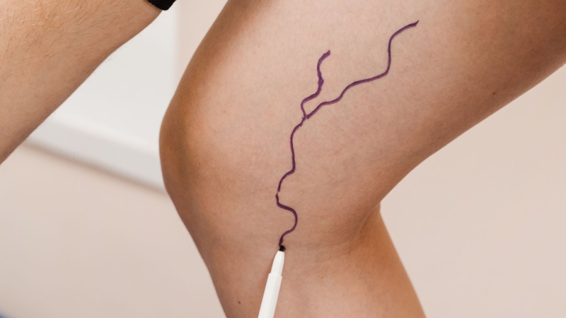 Tĩnh mạch hiển lớn đóng vai trò quan trọng với các chi dưới