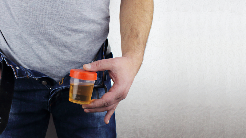 Mức lọc cầu thận phản ánh chức năng hoạt động của thận