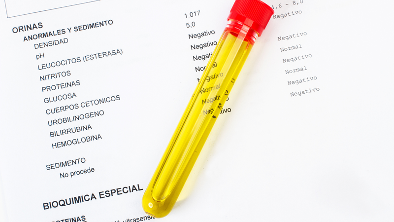 Ước tính GFR (eGFR) thường dựa trên nồng độ creatinine hoặc cystatin C trong máu