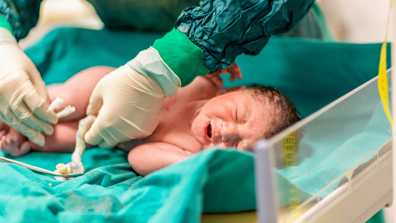 Tình trạng chồi rốn​ ở trẻ sơ sinh 1