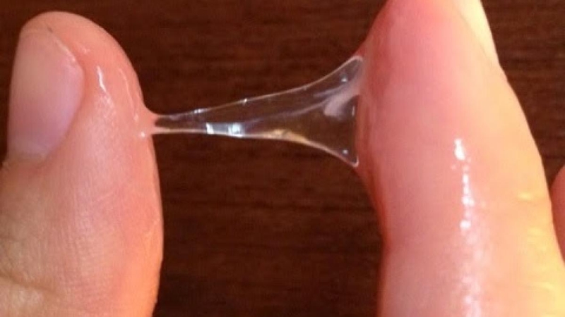 Tình trạng khí hư loãng như nước là bệnh gì?