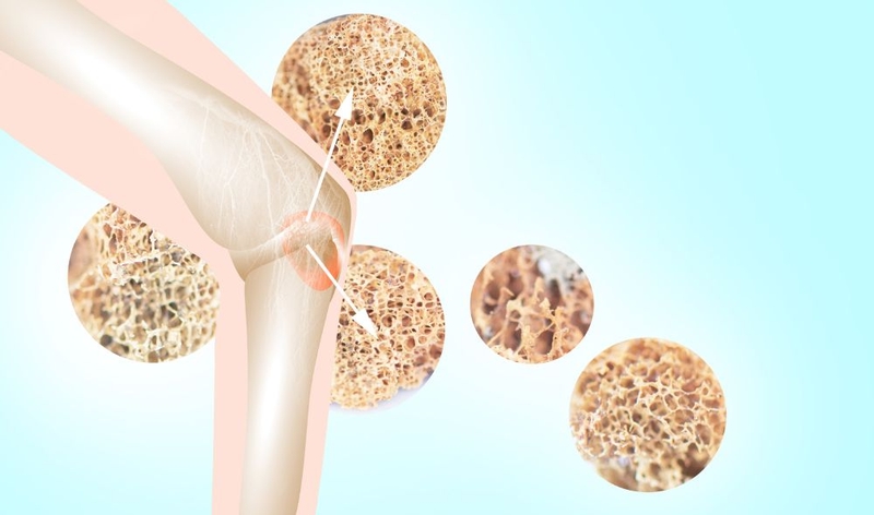 Tình trạng khớp gối kêu lạo xạo có nguy hiểm không? 2