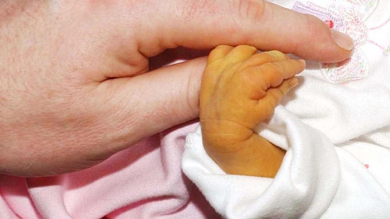 Tình trạng sinh non vàng da có nguy hiểm không? 2