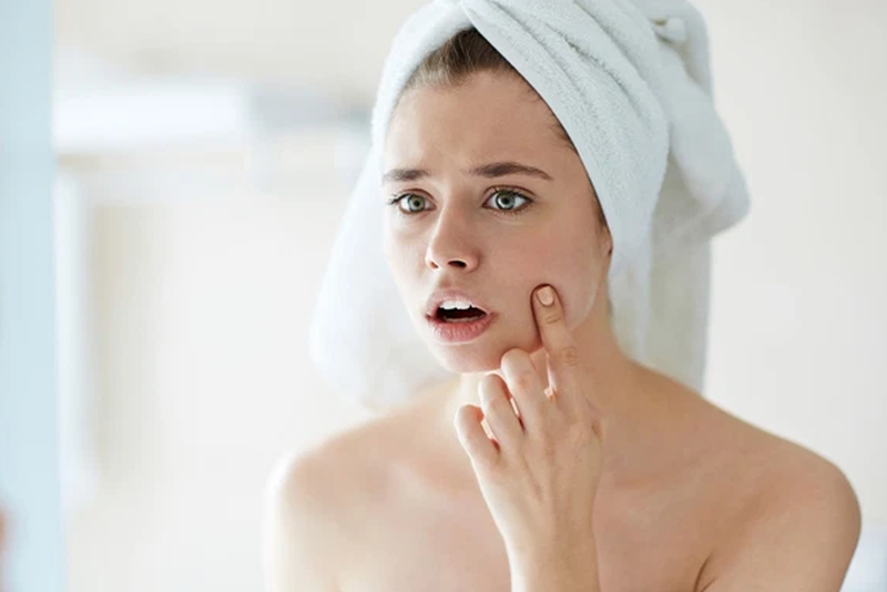 Suy nhược cơ thể khiến làn da xấu đi