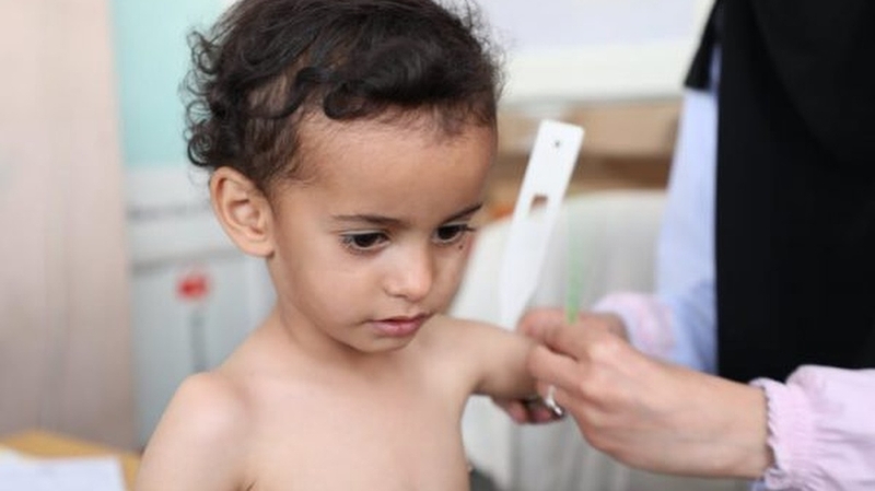 Tình trạng trẻ sụt cân không rõ nguyên nhân và cách xử lý hiệu quả 2