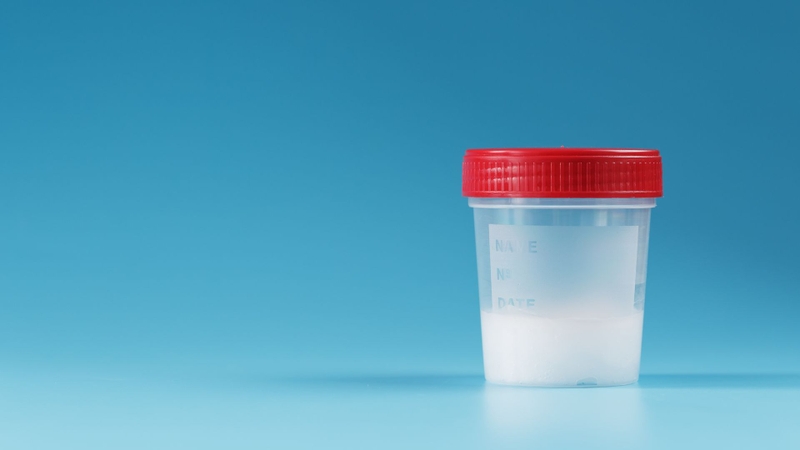 Tinh trùng bình thường như thế nào? Dấu hiệu tinh trùng yếu, bất thường thường gặp 3