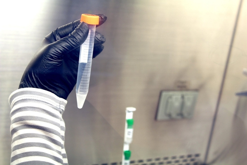 Tinh trùng không bào là gì? Điều trị tinh trùng không bào như thế nào? 2