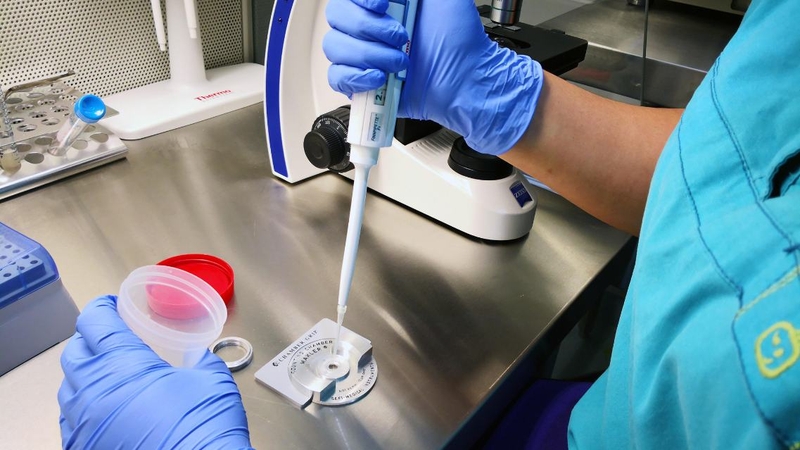 Tinh trùng màu gì thì bị vô sinh? Nhận biết màu sắc tinh dịch bất thường 2