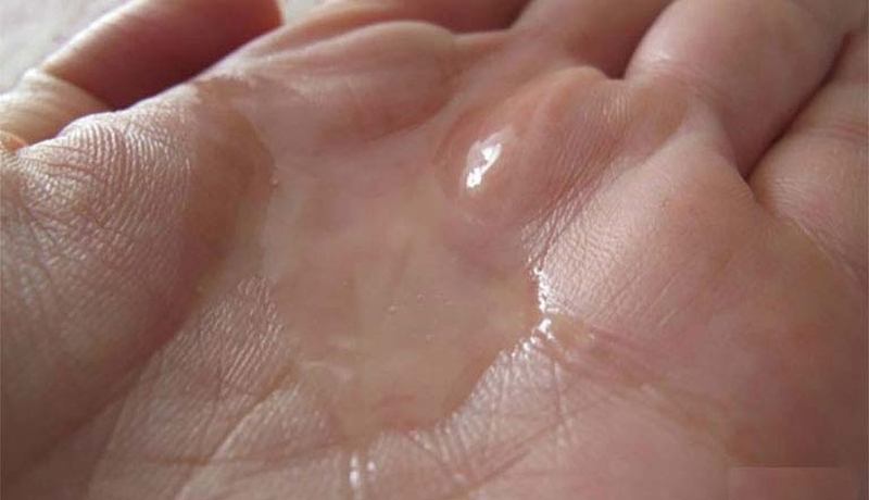 Tinh trùng màu trắng trong là biểu hiện của tinh trùng bị&nbsp;yếu, loãng