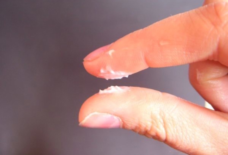 Tinh trùng vón cục ảnh hưởng đến sức khoẻ sinh sản nam giới