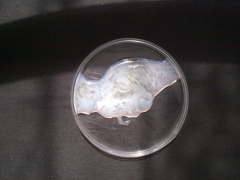 Tinh trùng yếu là nguyên nhân dẫn đến tình trạng vô sinh ở nam giới