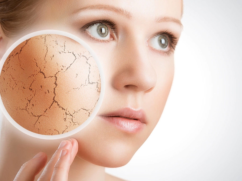 Típ chọn các loại kem dưỡng ẩm cho từng loại da 2