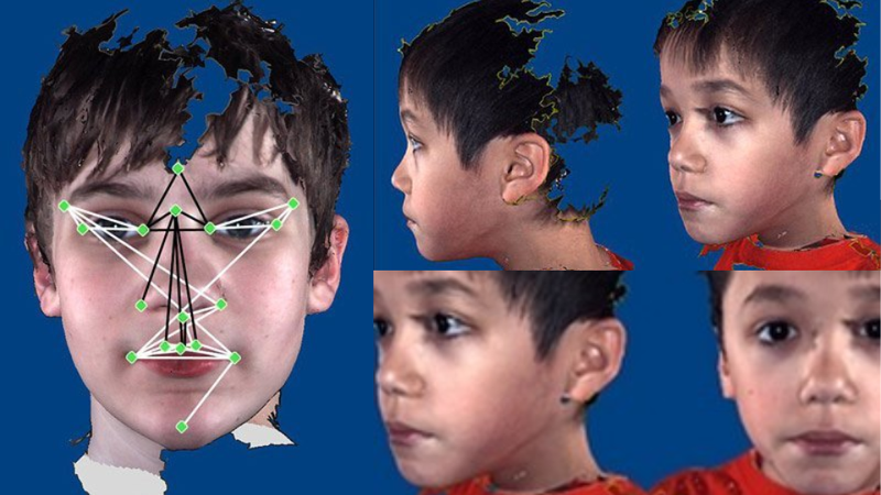 Khuôn mặt trẻ tự kỷ và những dấu hiệu nhận biết khác bố mẹ cần biết 2