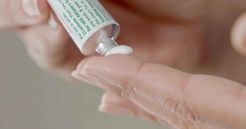 Tổ đỉa dạng mụn nước: Nguyên nhân, cách điều trị 3