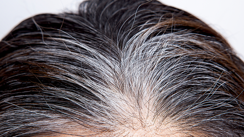 Tóc bạc ở trẻ em: Nguyên nhân, cách điều trị và những điều cha mẹ cần biết 1